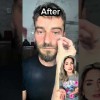 Eye Paches με Μικροκρυσταλλους  - Ενυδάτωση & Λεία Όψη Ματιών TICHYS