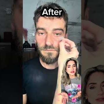 Eye Paches με Μικροκρυσταλλους  - Ενυδάτωση & Λεία Όψη Ματιών TICHYS