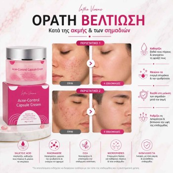 Κρέμα για Ακμή, Σπυράκια & Σημάδια με Salicylic Acid & Niacinamide 50g
