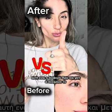 Βιταμίνη C Capsule Cream με Υαλουρονικό Οξύ, Νιασιναμίδη και Πεπτίδια – Κρέμα Λάμψης και Ενυδάτωσης