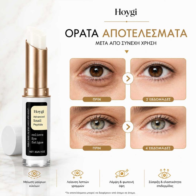 Eye Stick για μαύρους κύκλους και λεπτές γραμμές