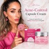 Κρέμα για ακμή, σπυράκια και σημάδια με Salicylic Acid και Niacinamide