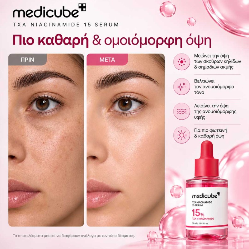 Ορός προσώπου με 15% Νιασιναμίδη και Tranexamic Acid για λιπαρότητα, πόρους και δυσχρωμίες