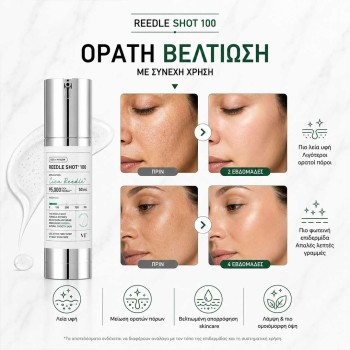 VT Cica Reedle Shot 100 Serum 50ml – Micro-Needle Booster για Λεία & Ανανεωμένη Όψη
